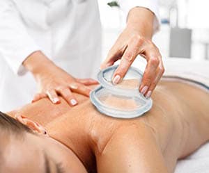 Cupping Massage - service image