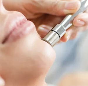 Microdermabrasion - service image